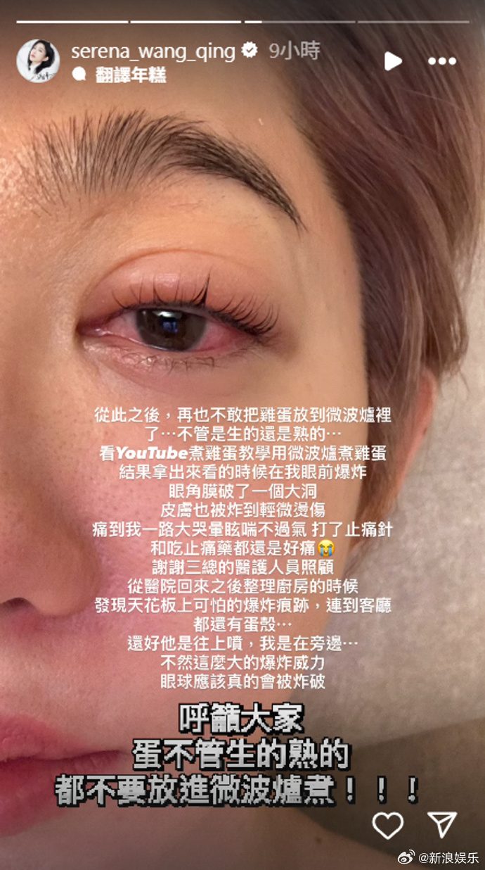 女演员竟用微波炉煮鸡蛋，结果鸡蛋在眼前爆炸，受伤后发声