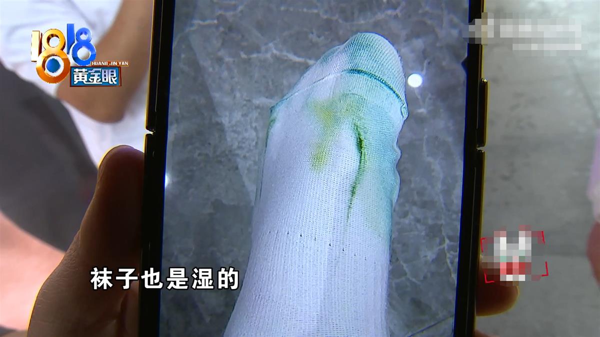 这双鞋子内衬是绿色的,他回家后发现湿了的白袜子被染上了绿色,脚指甲