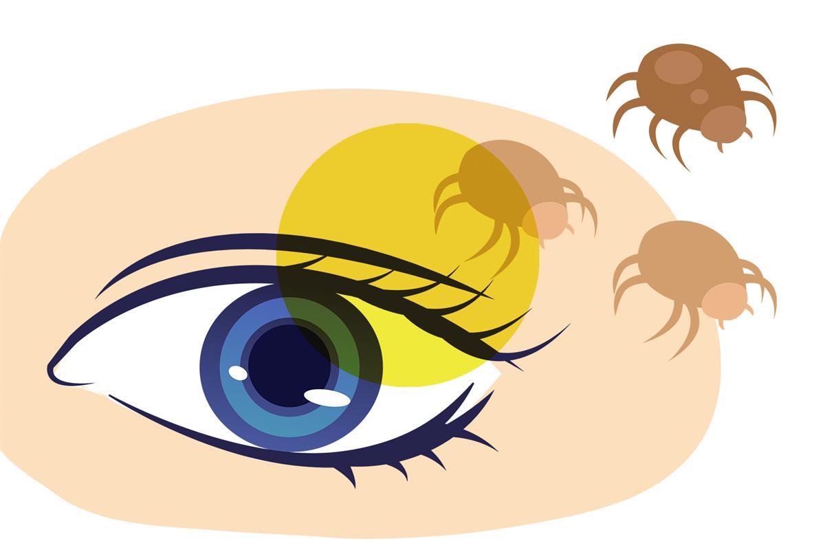 【新媒体用图laq】女主播眼睛无故干痒.jpg 【新媒体用图laq】女主播眼睛无故干痒.jpg