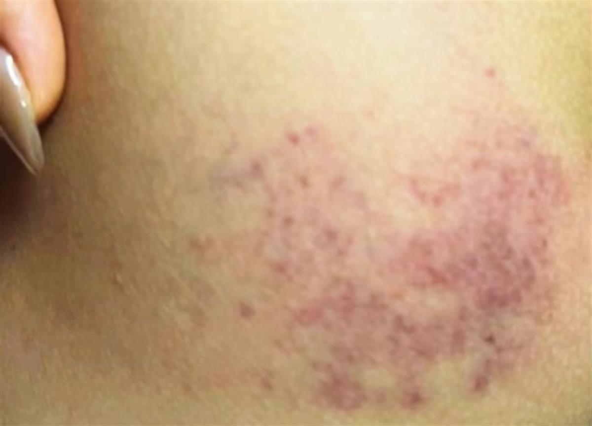 057c4303e8e0ecd69bdb860fd93aed53.jpg 057c4303e8e0ecd69bdb860fd93aed53.jpg