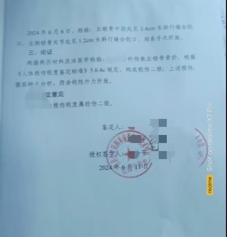 日照莒县一家长称孩子在校被老师打成轻伤二级，教育局介入处理，律师：已达到刑事立案追诉标准