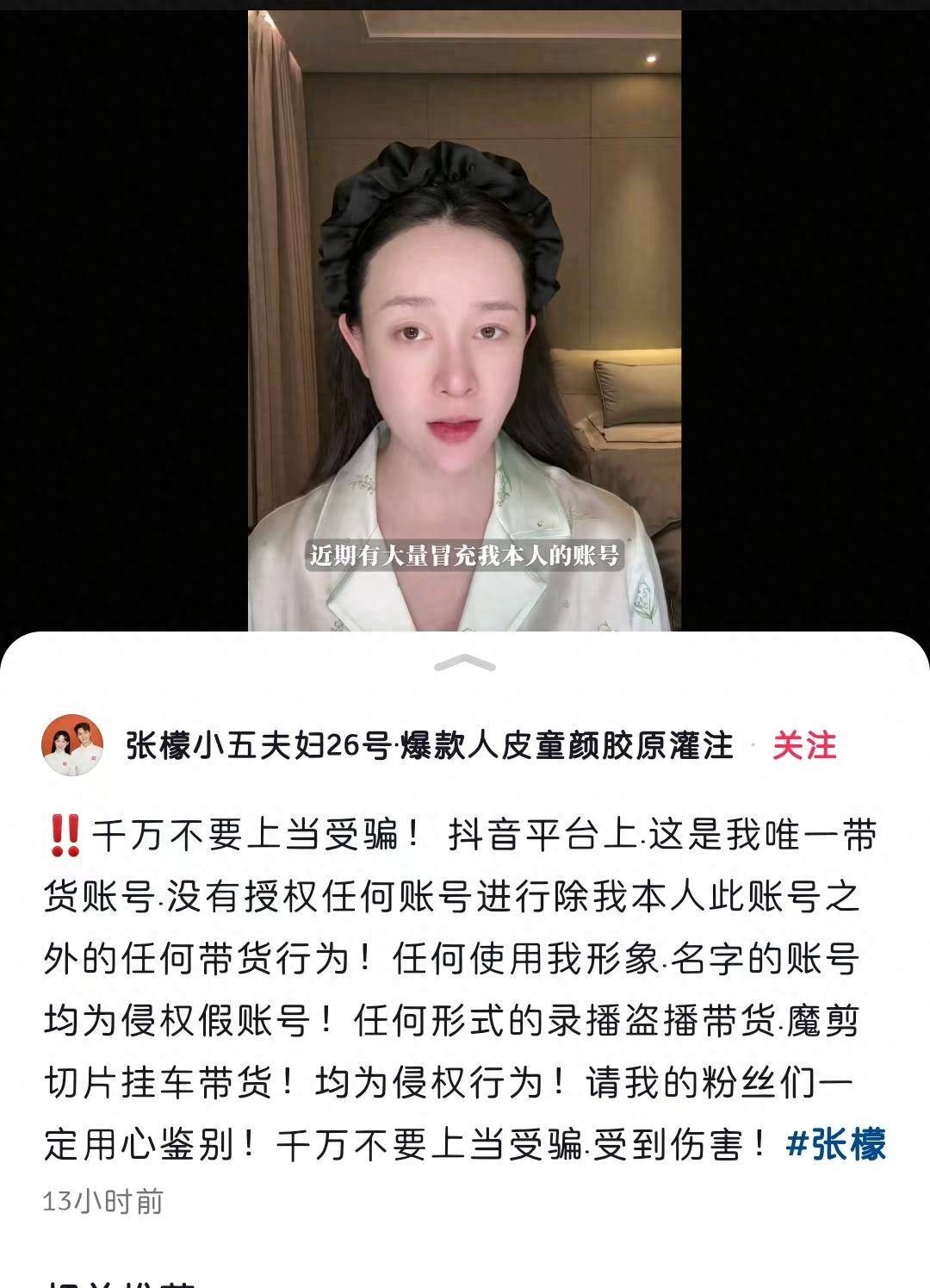 被上百个账号山寨了，演员张檬发声要求停止侵权