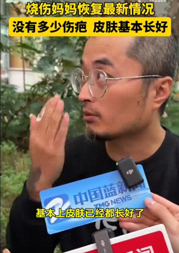 烧伤妈妈受伤皮肤快长好了！丈夫发声：争取10多天以后下地走路