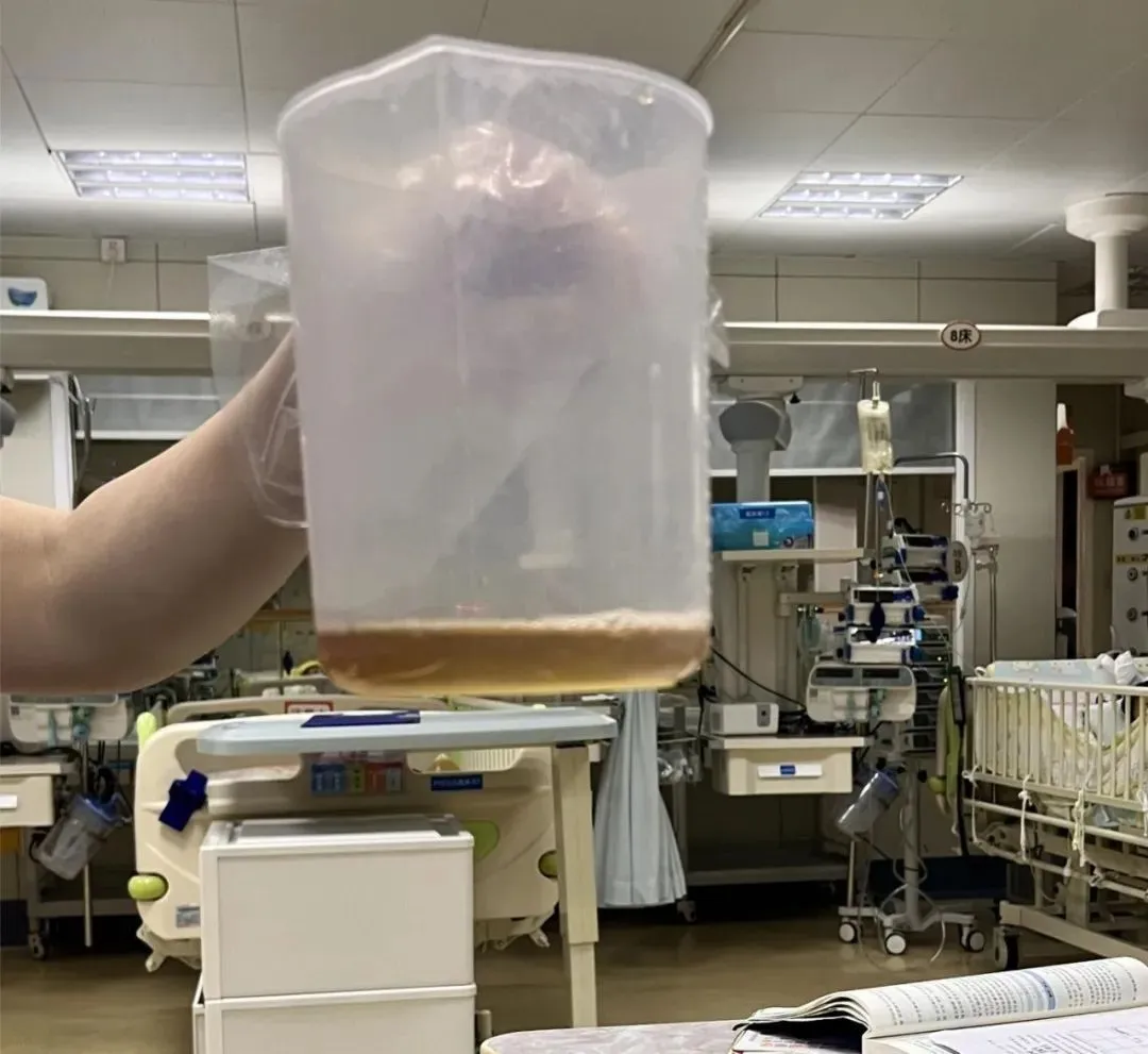 吃了一包零食，5岁娃进了ICU！这些人最易被这病“盯上”