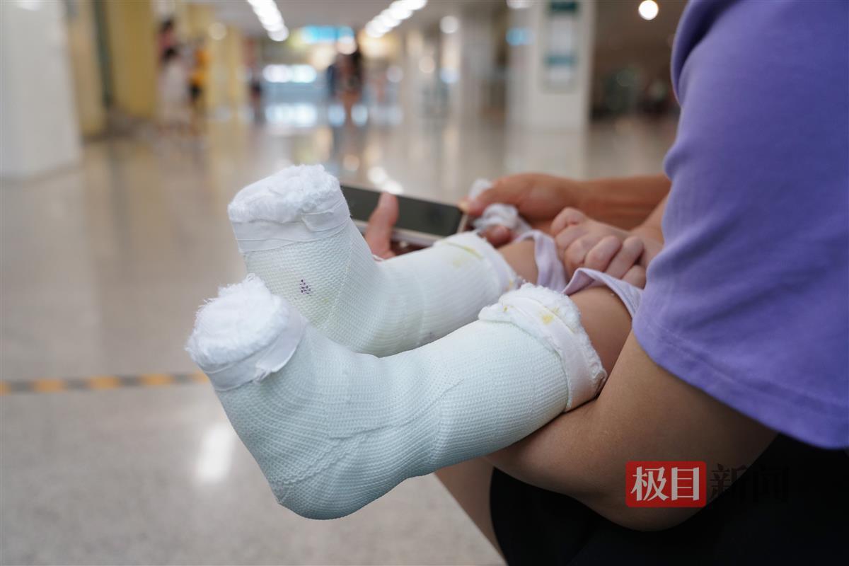 在武汉儿童医院，受伤的小朋友等待复查