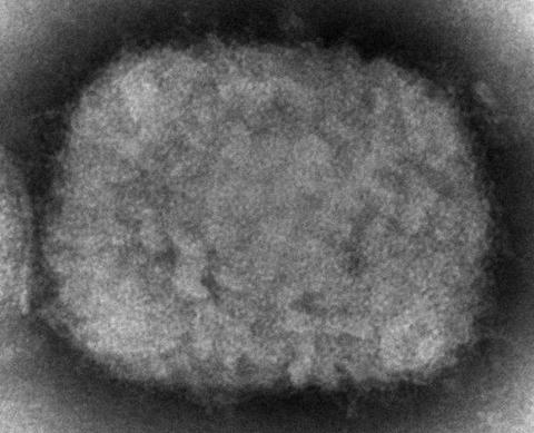 英专家警告：英国猴痘病例将“显著上升”病毒已在普通人中传播