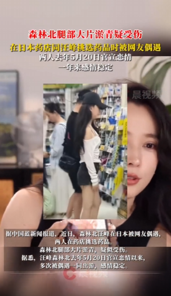 汪峰森林北在药店被偶遇，森林北腿部大片淤青疑受伤
