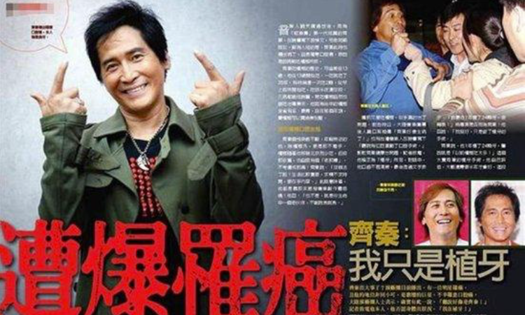 齐秦被曝罹患肺癌晚期，网友猜测与不良生活习惯有关