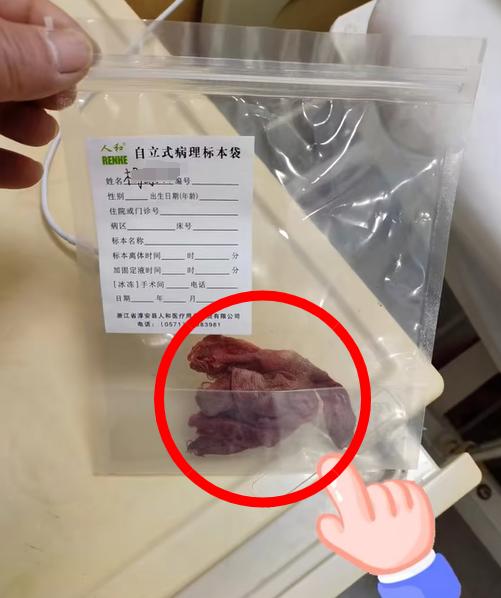 连云港一女子腹痛4年被发现体内有纱布！家属怀疑此前手术遗留，当地：正调查