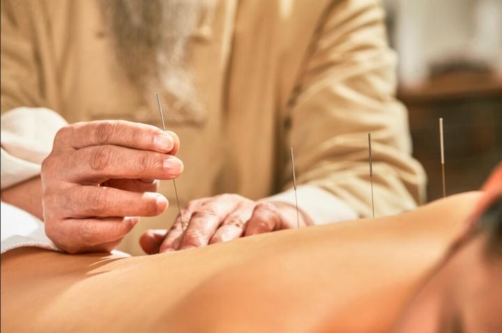 针灸.jpg