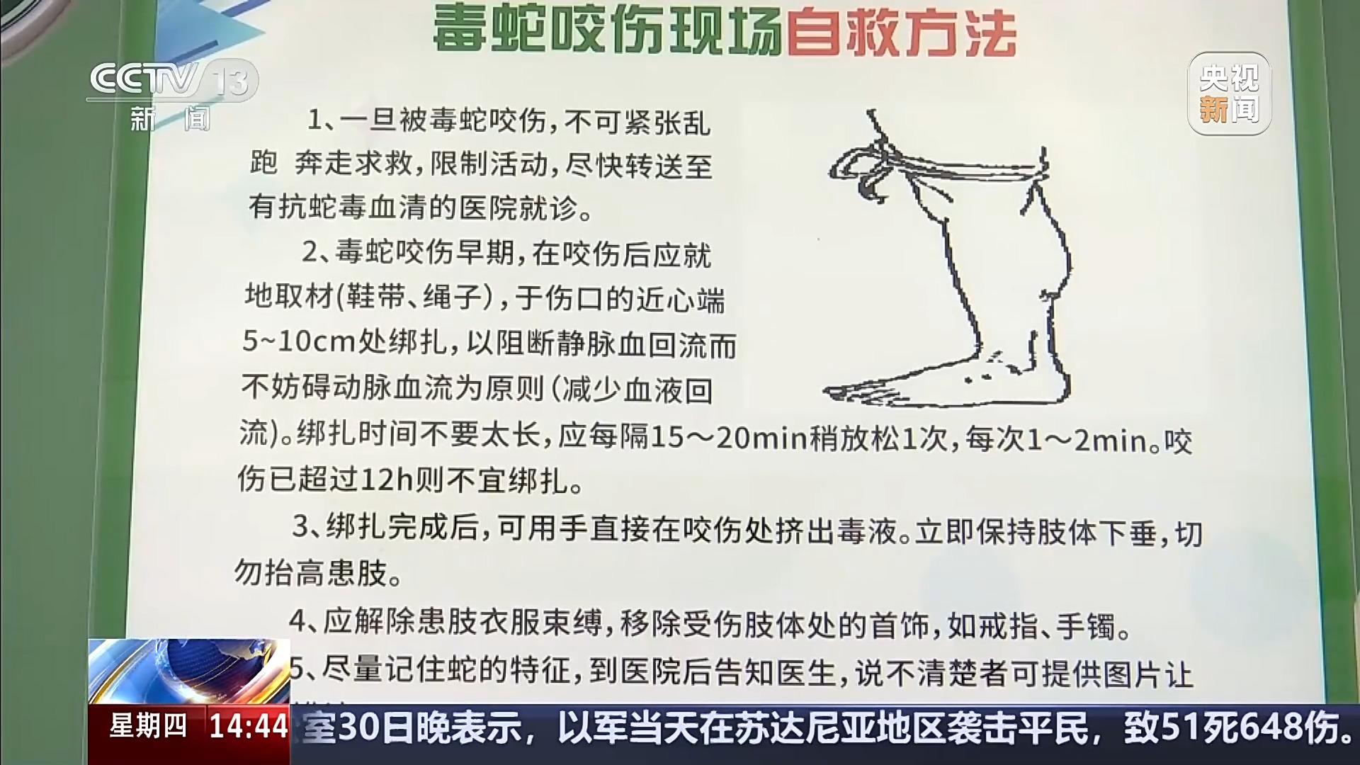 被毒蛇咬伤之后应该怎么办？注意千万不要用嘴吸吮伤口 | 极目新闻