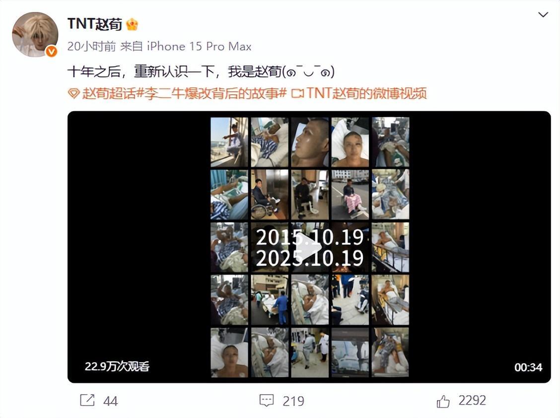 李二牛扮演者41岁演员赵荀转型美男，最新公布10年前重伤治疗画面：“拍戏时威亚断了，从三楼摔到水泥地上”