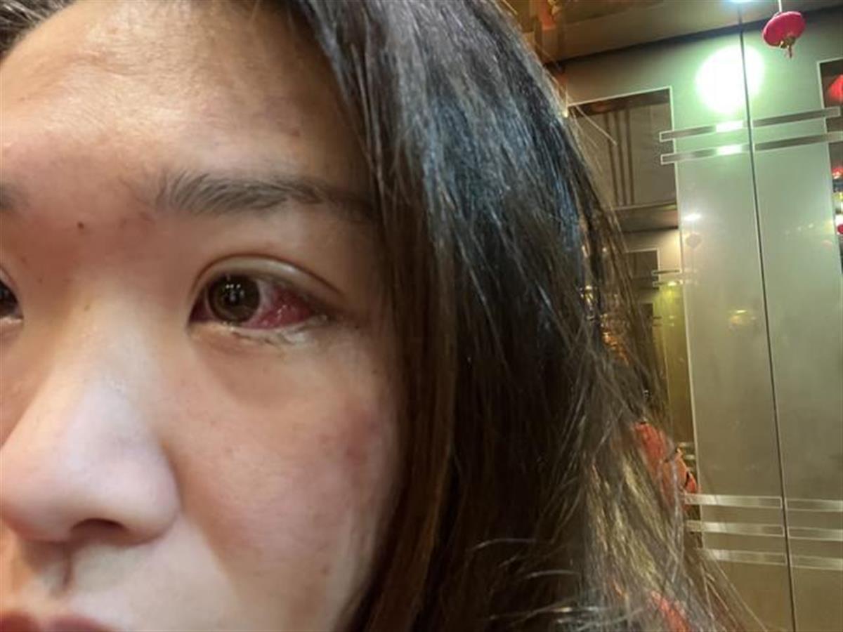 女足球员患急病或面临失明3小时获捐50万当事人盼病愈重返球场