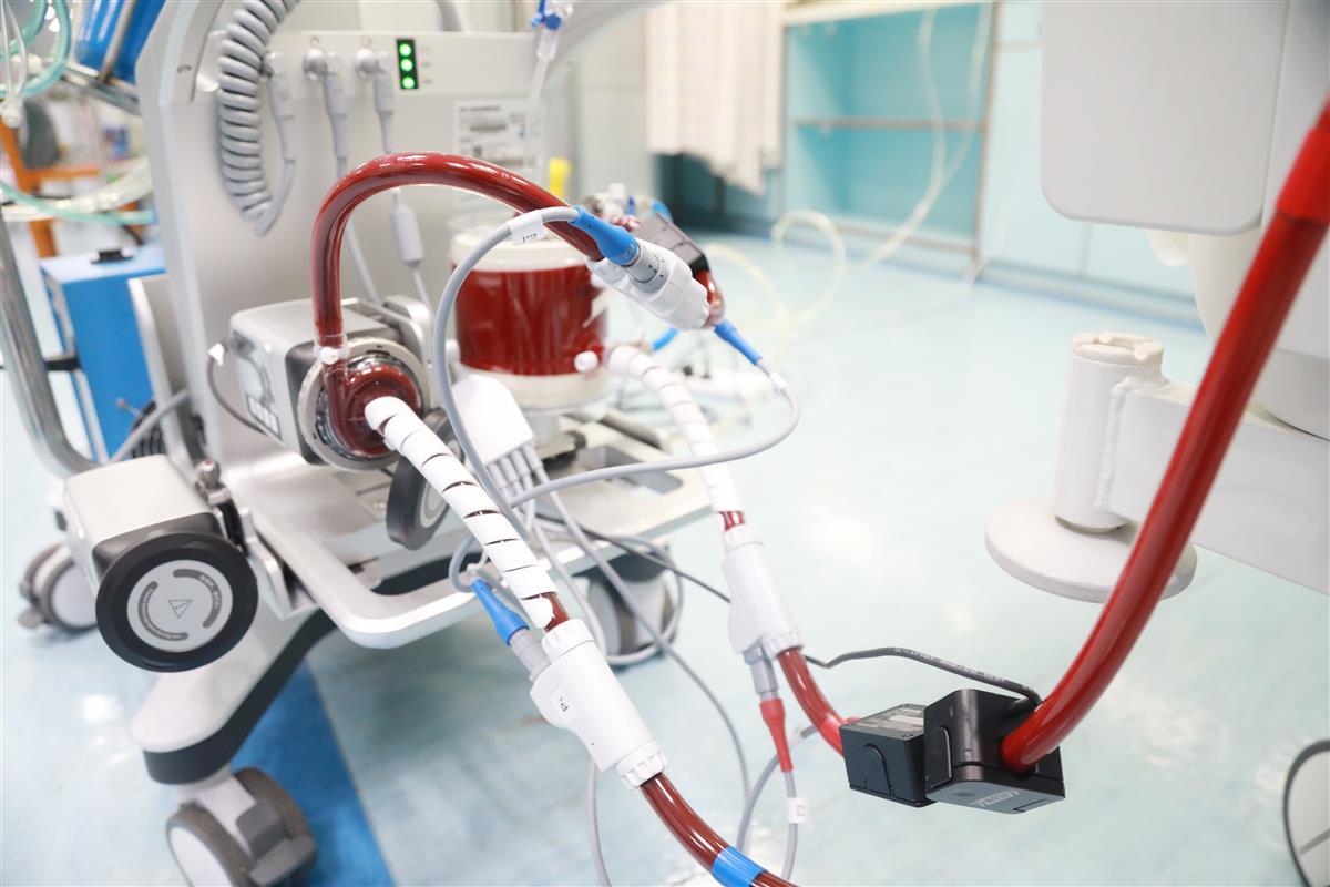 救命神器ecmo实现国产化六旬女子成为华中首例受惠者