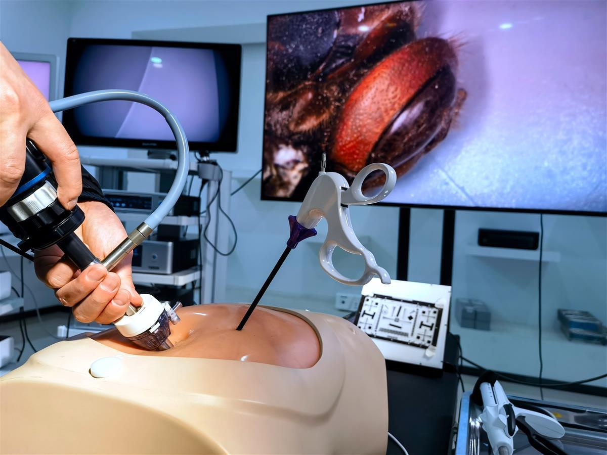 无影灯中间的是什么科技成果“唤醒记”：手术医生的高清“第三只眼”这样炼成_https://www.jmylbn.com_新闻资讯_第2张