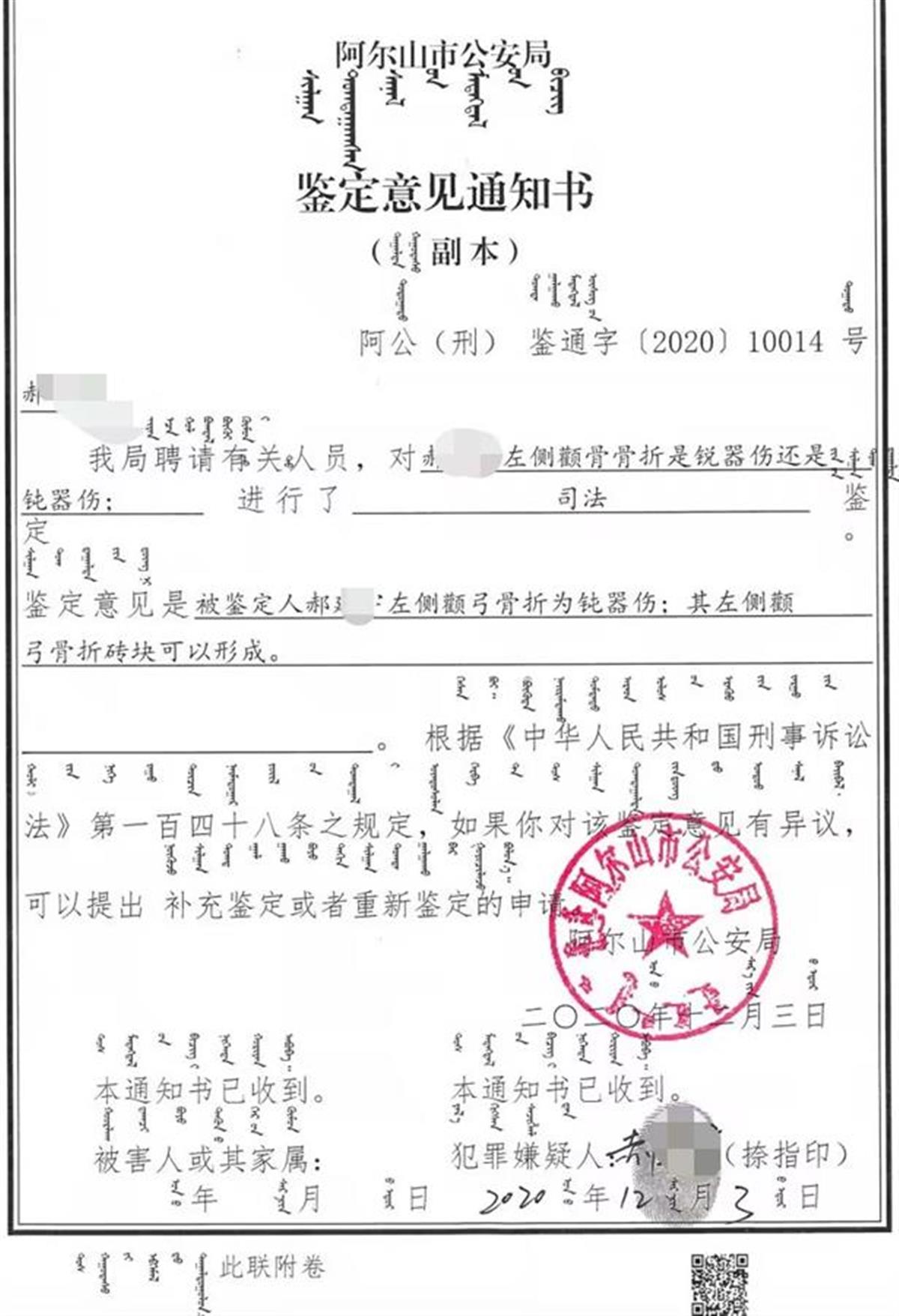 男子被砍后持砖反杀对方：检方作不起诉决定1年后撤销，法院一审判刑10年-第4张-信息-51硕博论文