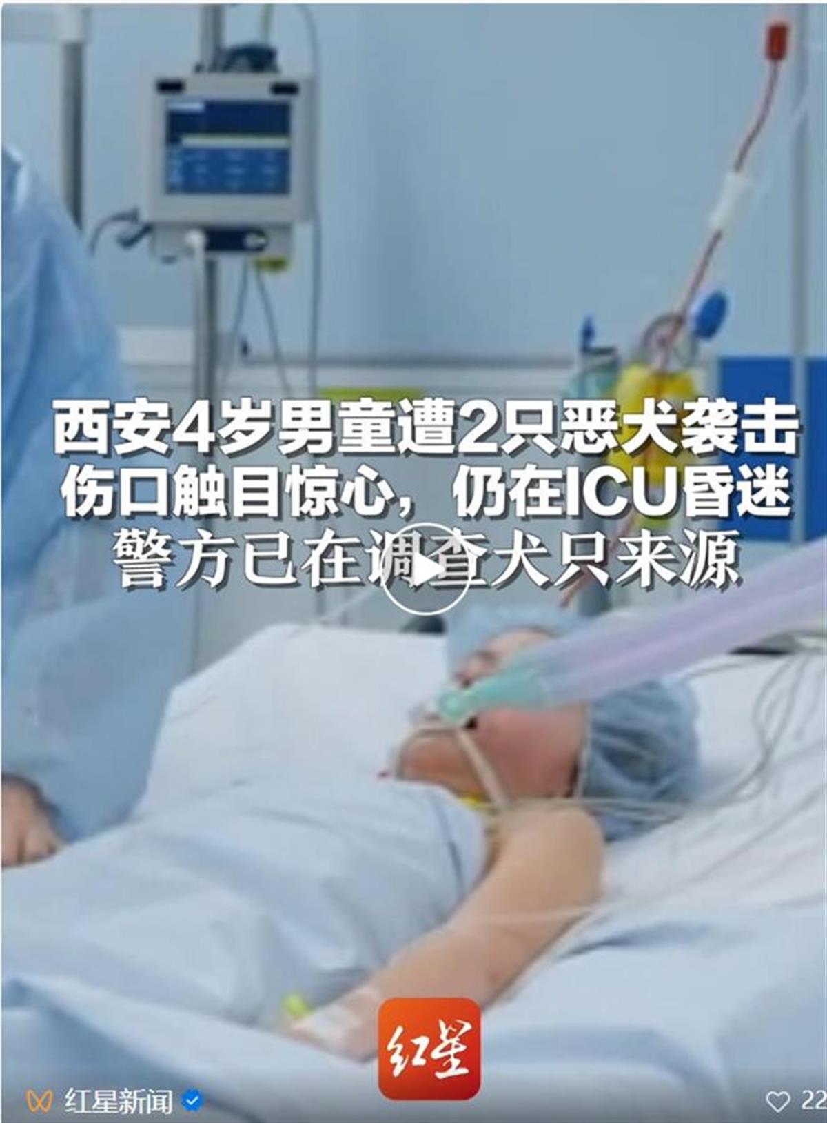 A4岁童遭恶犬袭击.png