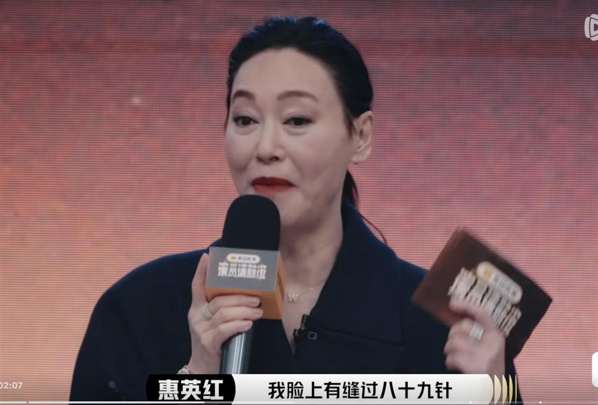 惠英红坦白曾整容，称面部受伤缝过89针，节目中被问“谁整过容”，45名演员仅1人站出