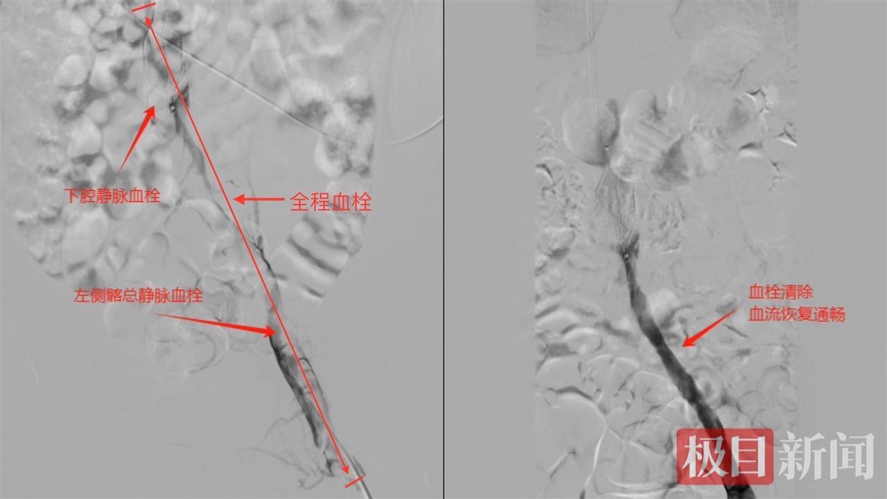 mmexport1750924318653.jpg mmexport1750924318653.jpg