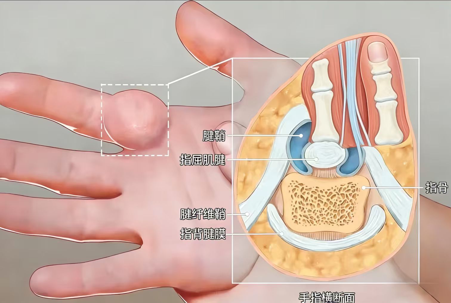 19ea35ec90ef9ffb7dfb157594f50ffa.jpg 19ea35ec90ef9ffb7dfb157594f50ffa.jpg