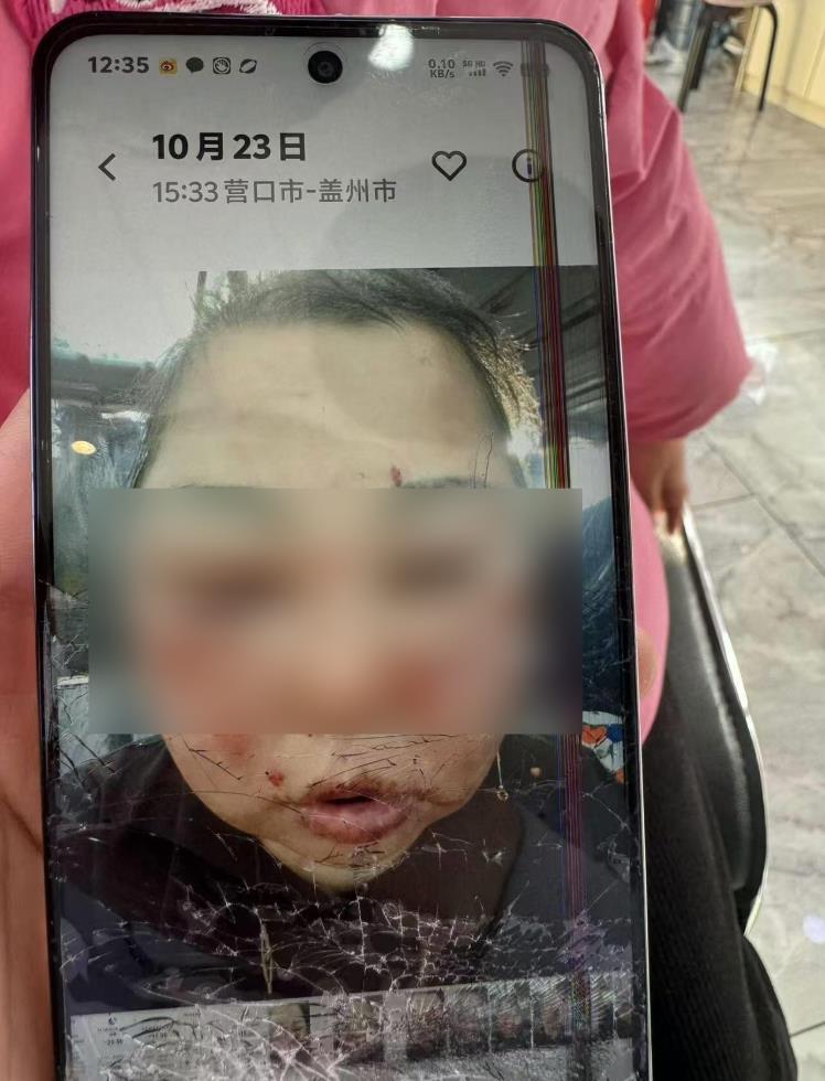 cb8cb95d0b46c48a3c17c8f3498bd1b0.png cb8cb95d0b46c48a3c17c8f3498bd1b0.png