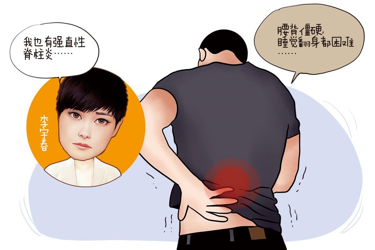 【新媒体lijingyi】李宇春患强直性脊柱炎 这种病和基因有关.jpg