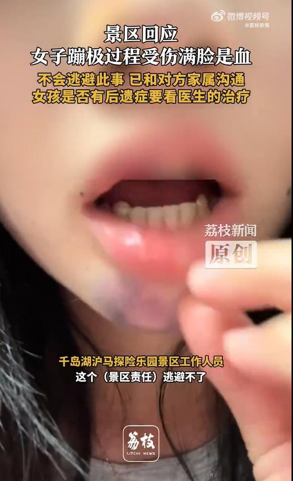 极目锐评丨女子景区玩蹦极被磕成脑震荡，说好的安全第一呢？