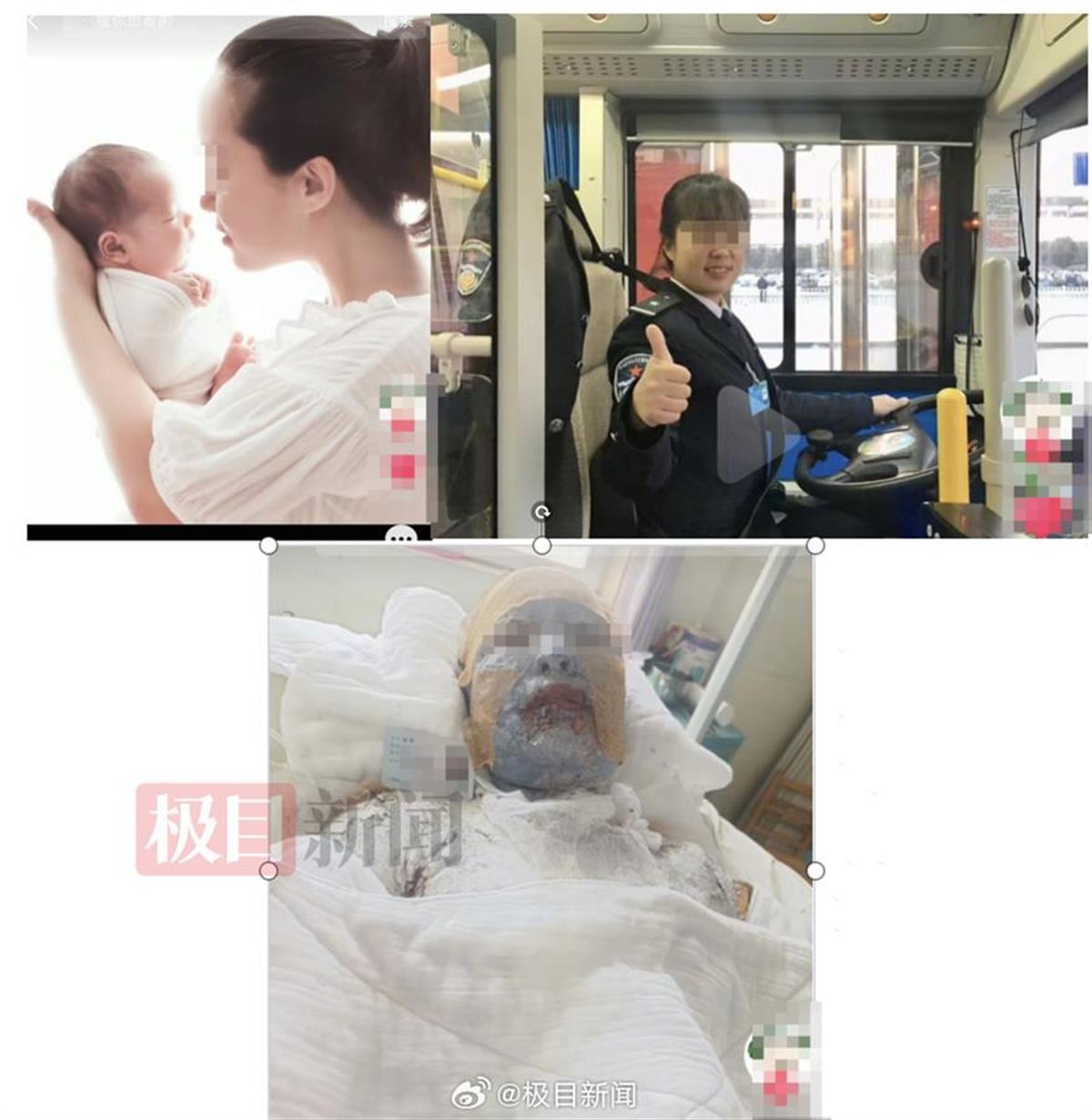 妻子遇液化气泄漏爆炸全身超九成烧伤，丈夫全网求助：“不敢想象她该有多疼”