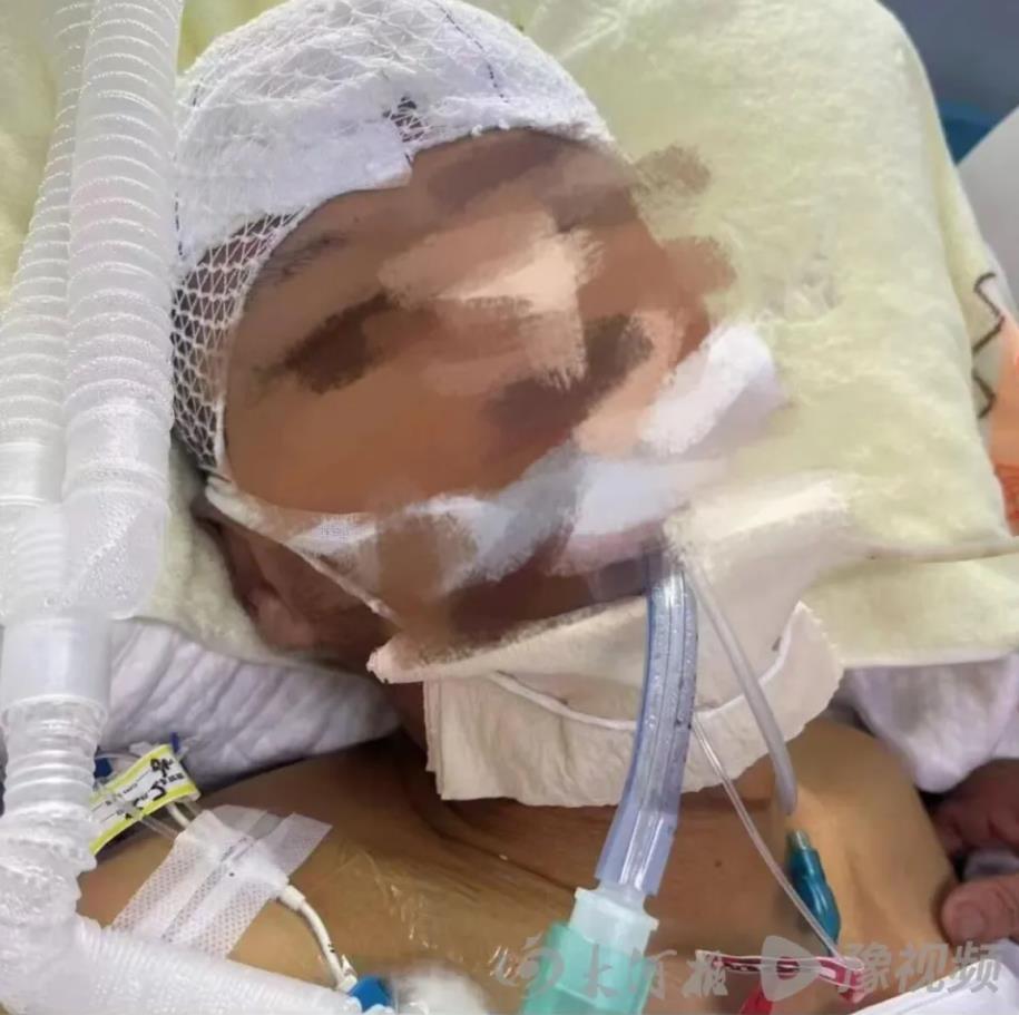 脑梗患者死亡背后的医疗悲剧，过度医疗的警示与反思