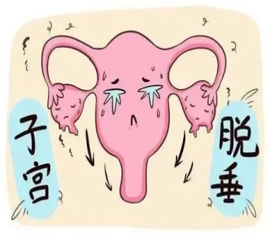 大姐每天采茶12小时子宫掉出体外？警惕子宫脱垂“隐形危机” | 极目新闻