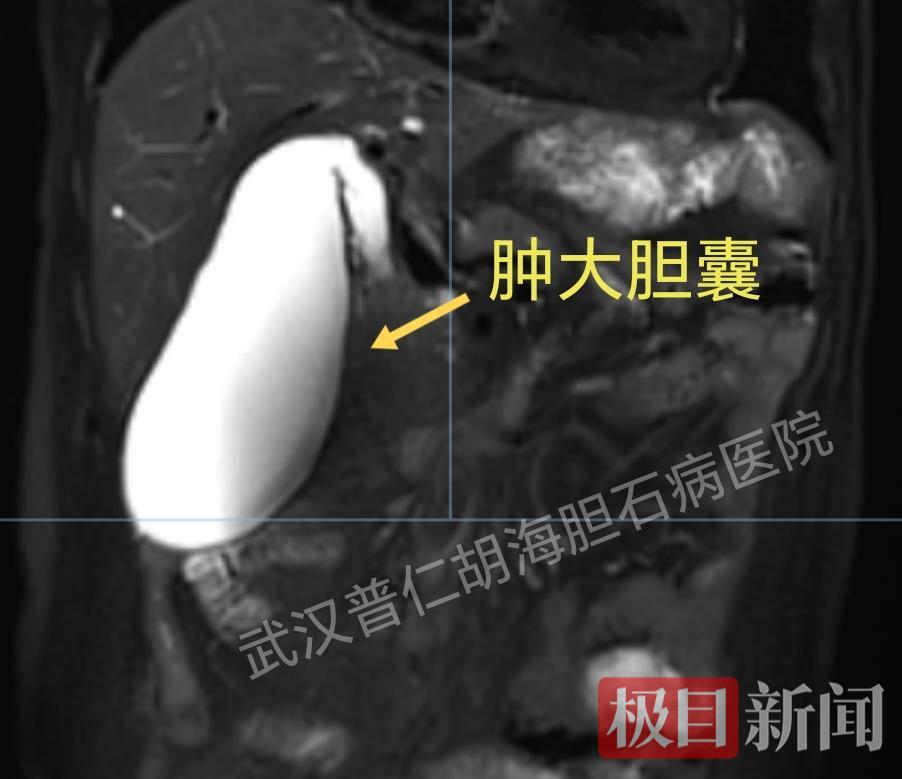 mmexport1747295005061.jpg
