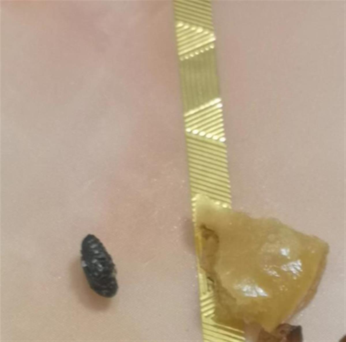 为您跑腿|蚕豆里吃出一只黑虫子,生产企业:"蚕豆虫对身体无害" | 极目